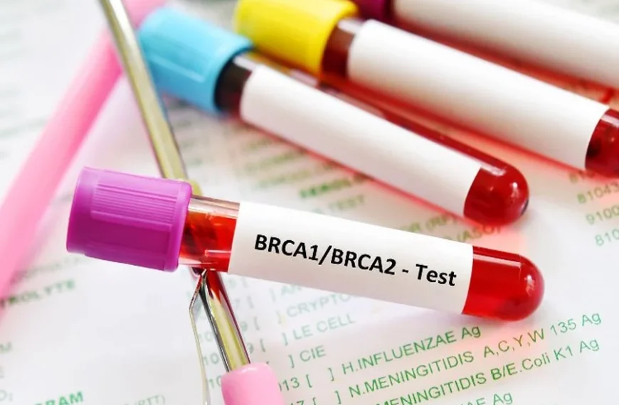 BRCA Test