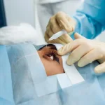 Benefits of SMILE Surgery Over Traditional Lasik Surgeries