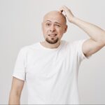 Early Signs of Male Pattern Baldness and When to Take Action